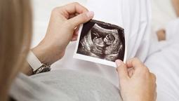 Непорочне зачаття: як "завагітніла" волинська журналістка (фото, відео)