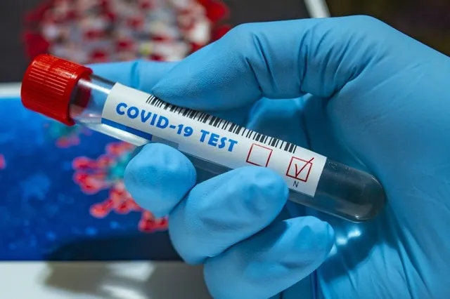 За добу в Україні – 5 469 нових випадків COVID-19, на Волині – 178