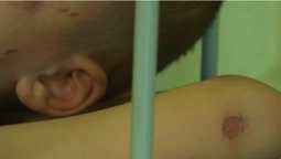 Хлопчик у реанімації: луцькі лікарі прокоментували стан дітей, яких побив батько (фото)