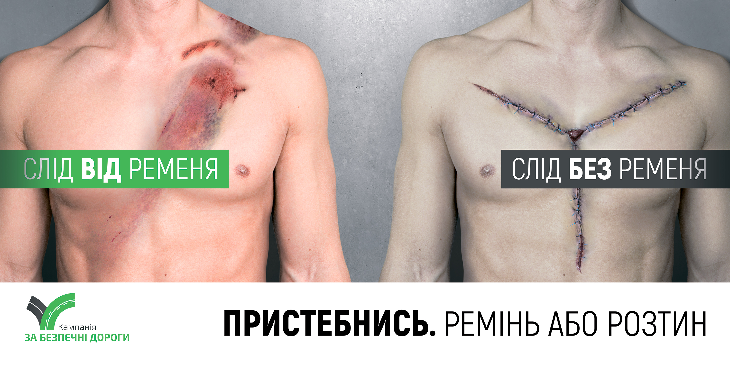 Ремінь або розтин: у Луцьку з'явилася шокуюча реклама