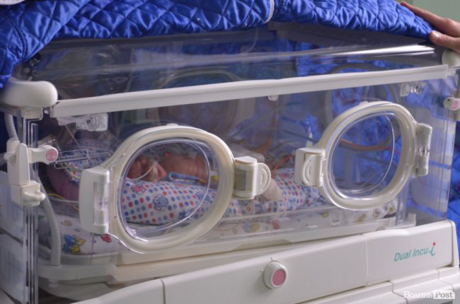 Народитися і вижити: як у перинатальному центрі виходили 800-грамового малюка