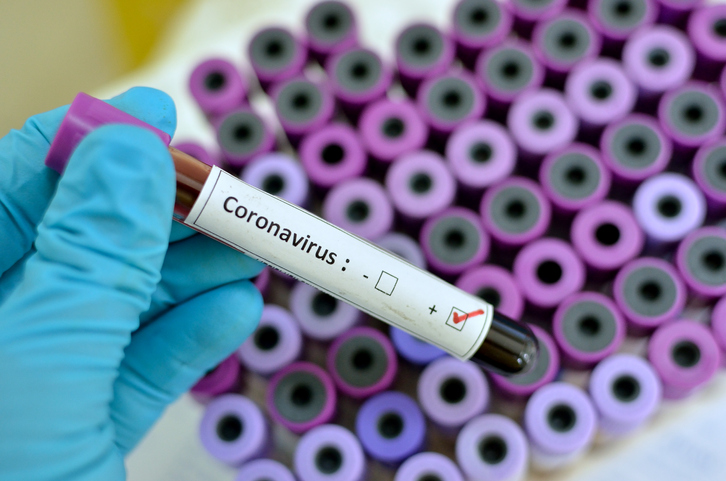 42 людей в Україні перевіряють на коронавірус