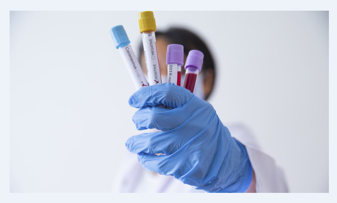 У Німеччині масово тестуватимуть на імунітет до коронавірусу і даватимуть сертифікат