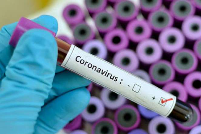 В Україні зафіксовано 311 випадків зараження коронавірусом: скільки на Волині