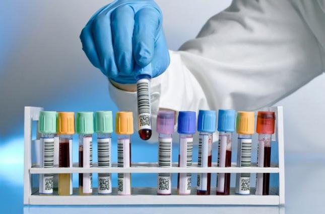 Новий аналіз крові дозволить виявити 50 видів раку