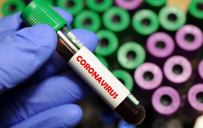 У Франції інфікованим COVID-19 переливатимуть плазму крові тих, хто одужав