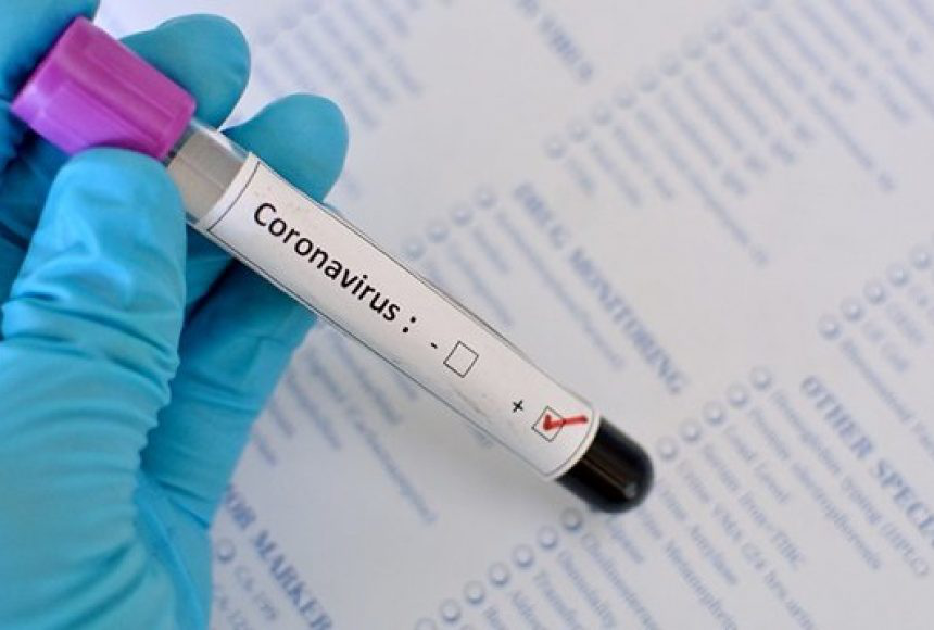 В аптеках Волині вже є експрес-тести на коронавірус