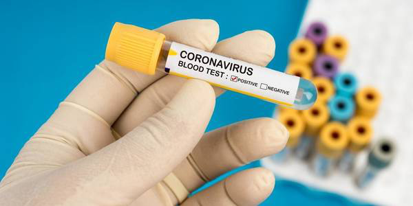 Тест на коронавірус: чи потрібно платити