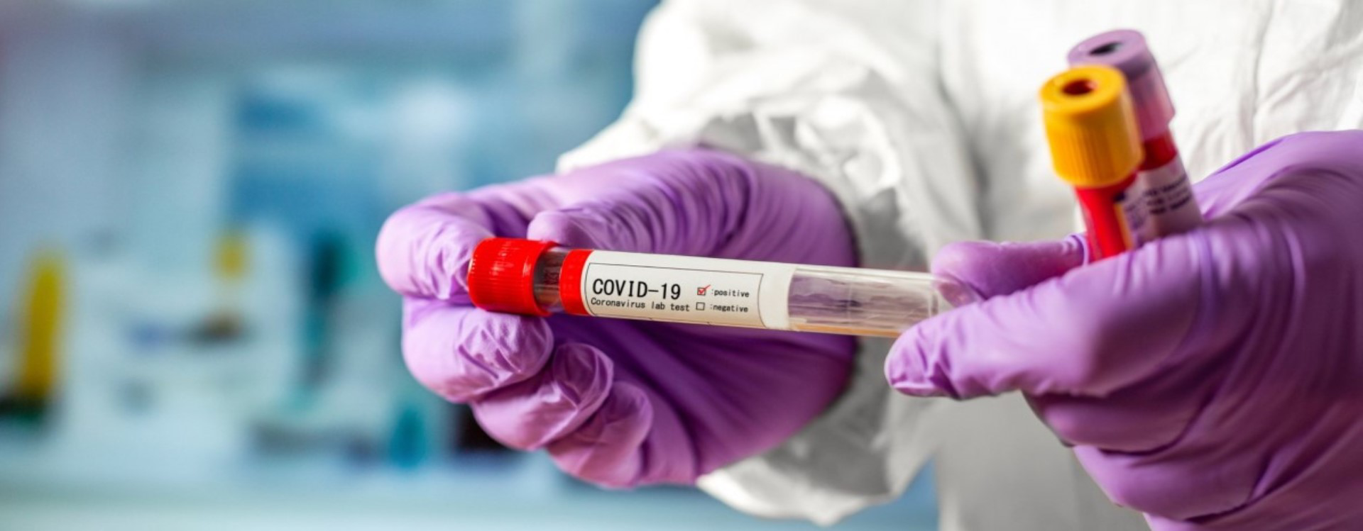 На Волині – 16 нових випадків коронавірусу: 6 зареєстрували у Луцьку