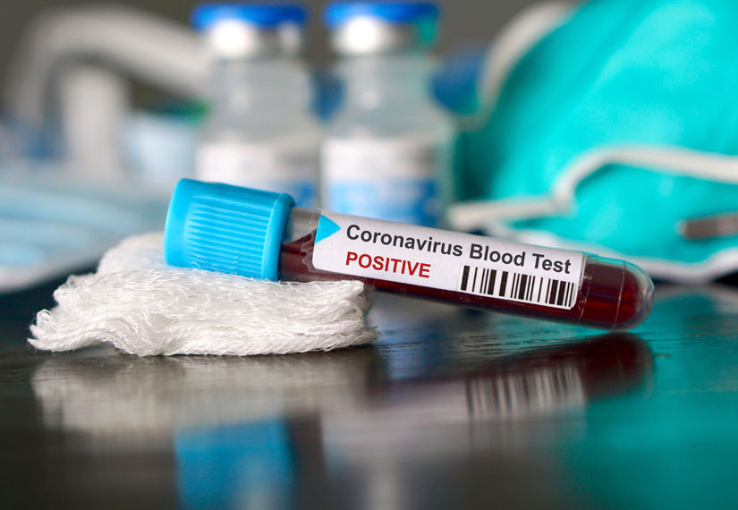 На Волині – 6 нових випадків коронавірусу: де реєстрували