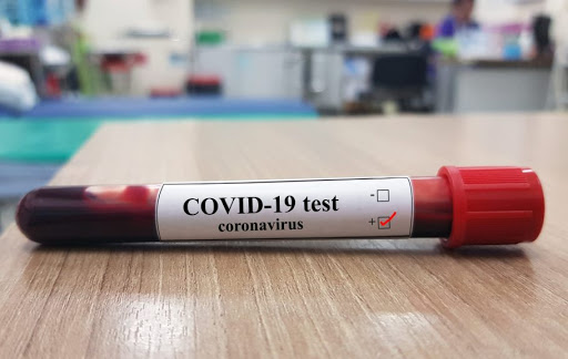 Волинь – на 8-му місці за рівнем захворюваності на коронавірус: що відомо про спалахи