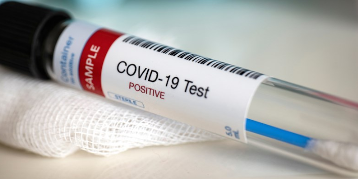За добу на Волині – 22 нових випадки COVID-19: де реєстрували