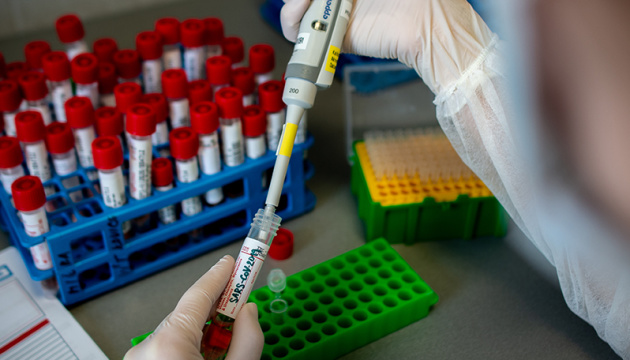 За добу в Україні – 340 нових випадків коронавірусу