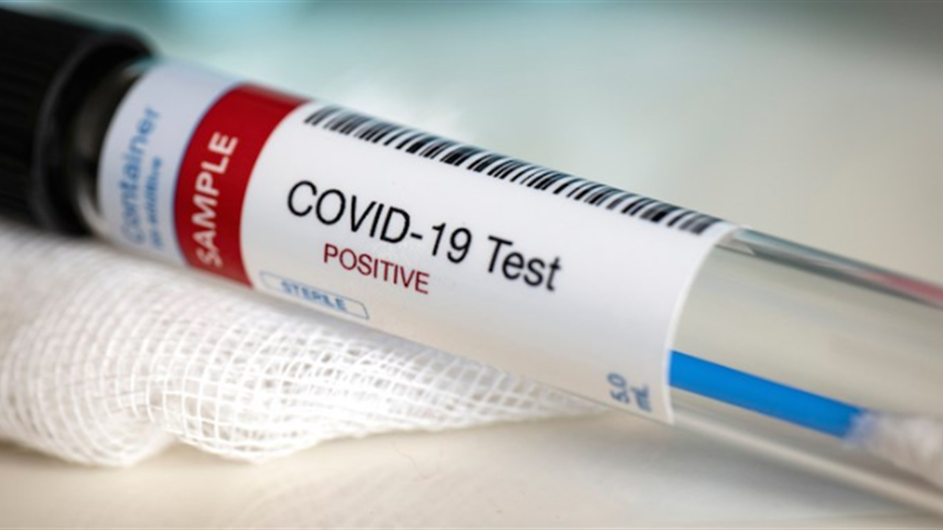 За добу на Волині – 27 нових випадків COVID-19 та дві смерті