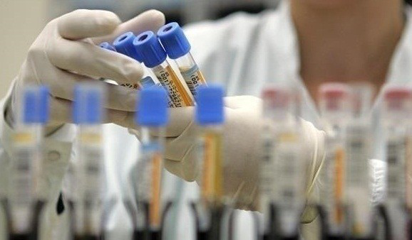 За добу в Україні – понад 900 нових випадків коронавірусу
