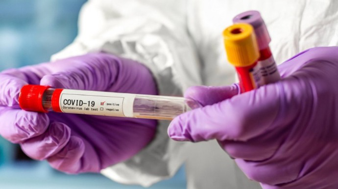 На Волині за добу – 39 нових випадків коронавірусу: де реєстрували