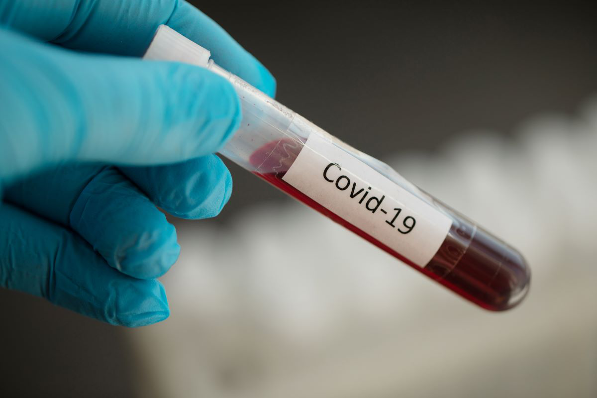 Коронавірус на Волині: за добу – 37 нових випадків та дві смерті
