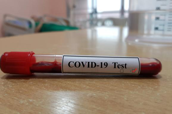 За добу в Україні – 919 нових випадків коронавірусу, на Волині – 32