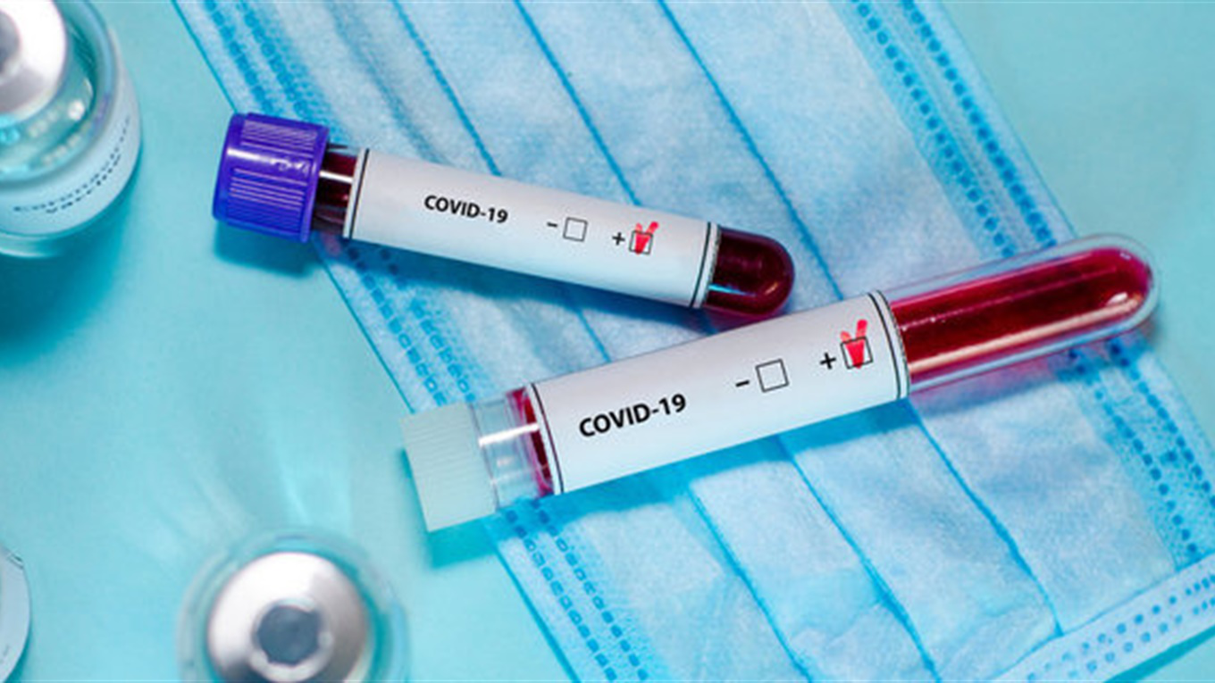 Коронавірус на Волині: за добу – 40 нових випадків і дві смерті