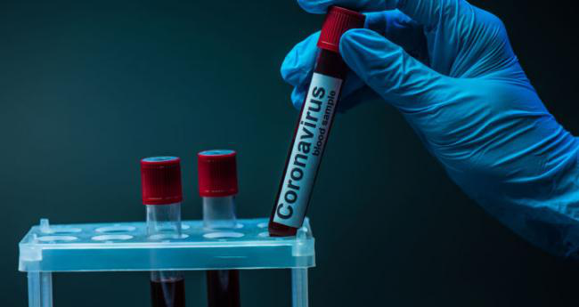 На Волині за добу – 52 випадки коронавірусу: де реєстрували