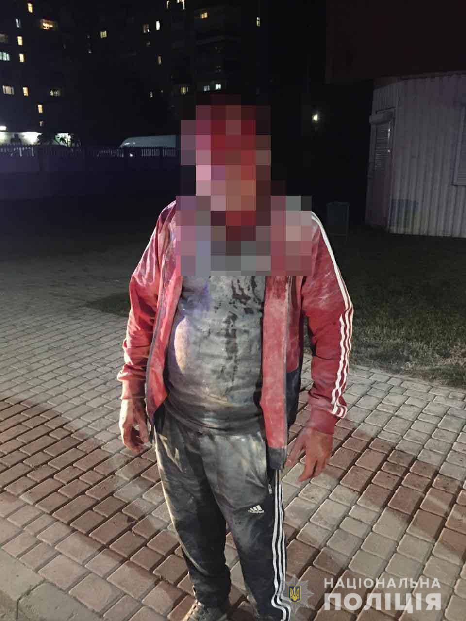 Вдарив вогнегасником і пограбував: у Володимирі затримали розбійника (фото)