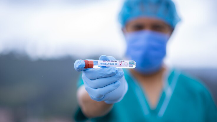 Коронавірус на Волині: за добу – 76 нових випадків і дві смерті