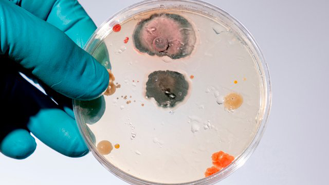 В міських водогонах США знайшли смертельний мікроб, який пожирає мозок
