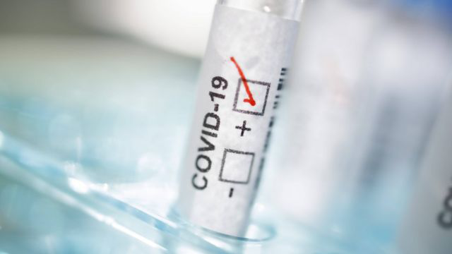 Результат за 5 хвилин: польська фірма представила новий тест на коронавірус