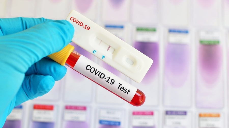 За добу в Україні –  9 721 новий випадок COVID-19, одужало 10 762 осіб