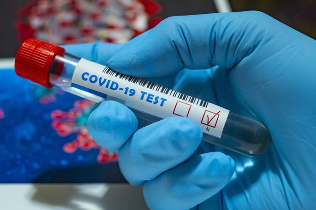 За добу в Україні – 13 825 нових випадків коронавірусу, на Волині – 328
