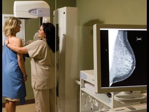 Мамографія: де можна зробити на Волині і що для цього потрібно