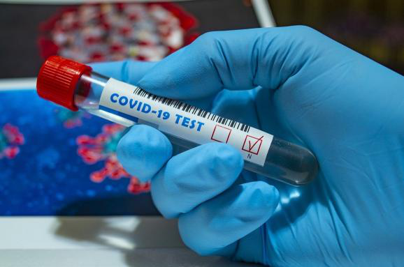 Коронавірус на Волині: за добу – 178 нових випадків