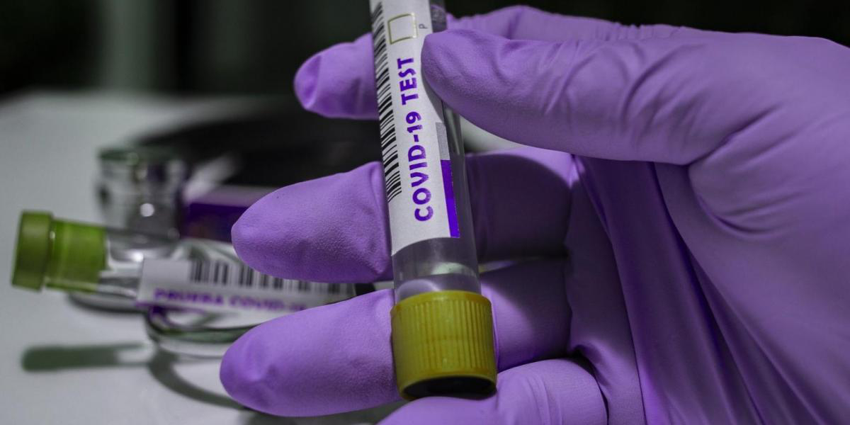 Коронавірус на Волині: за добу – 317 нових випадків і 11 смертей