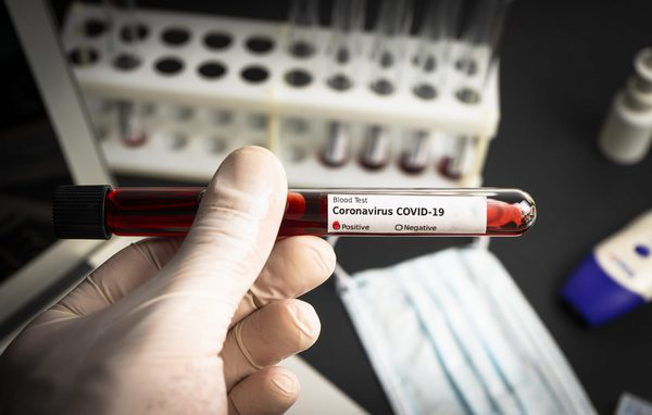 Коронавірус на Волині: за добу – 455 нових випадків і 10 смертей
