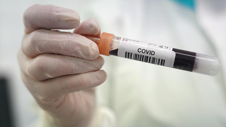 За добу в Україні від коронавірусу одужало 5 733 людини