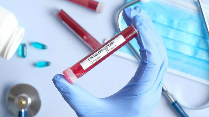 За добу в Україні – 450 нових випадків коронавірусу