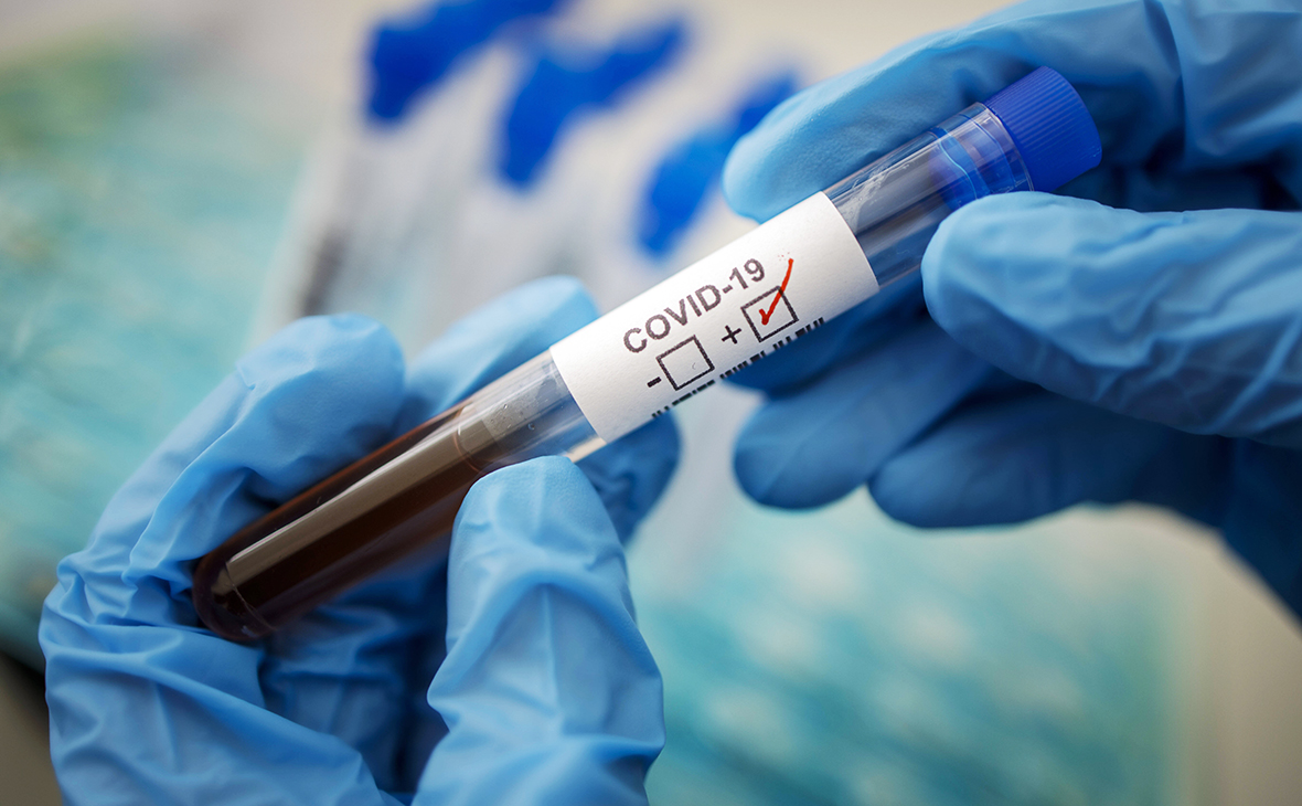 За добу в Україні – 705 нових випадків коронавірусу