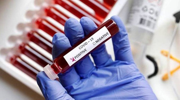 За добу в Україні –  377 нових випадків коронавірусу