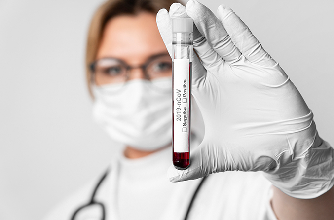 За добу в Україні – 623 нові випадки коронавірусу