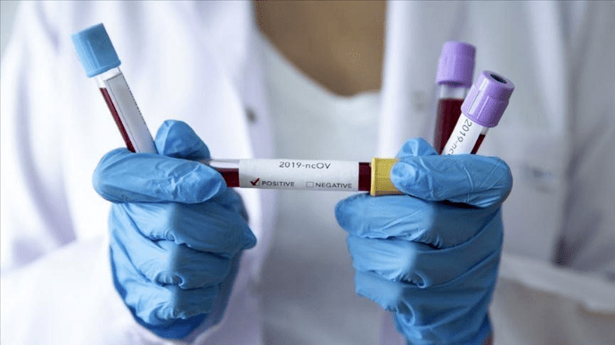 За добу в Україні – 763 нові випадки коронавірусу