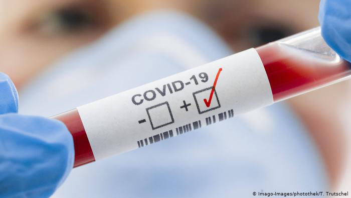 В Україні виявили 1 263 випадки зараження коронавірусом
