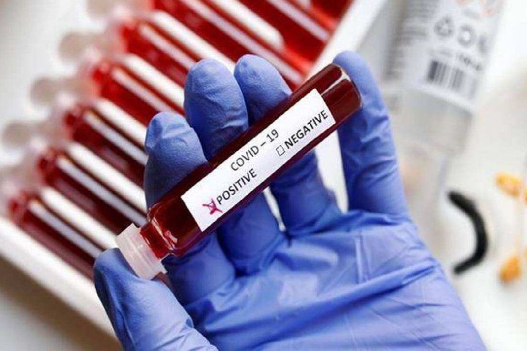 За добу в Україні – 417 нових випадків коронавірусу