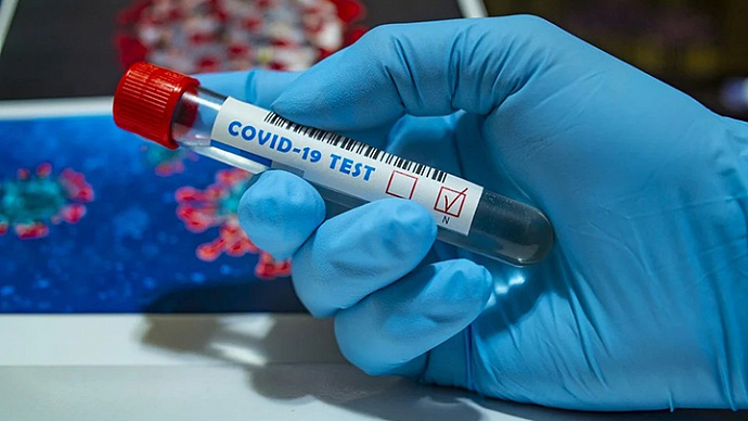 На Волині виявили 19 нових хворих на коронавірус