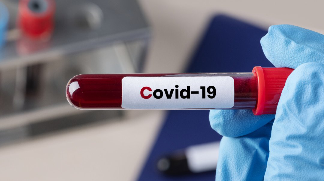 Коронавірус на Волині: за добу – 571 новий випадок і 25 смертей