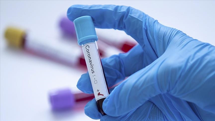 За добу в Україні – 4073 нові випадки коронавірусу