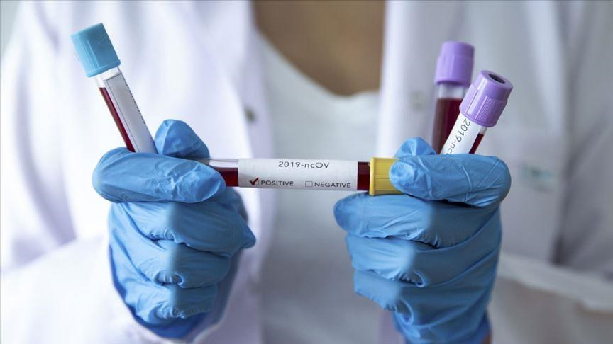 Коронавірус на Волині: виявлено 58 нових випадків, одна людина померла