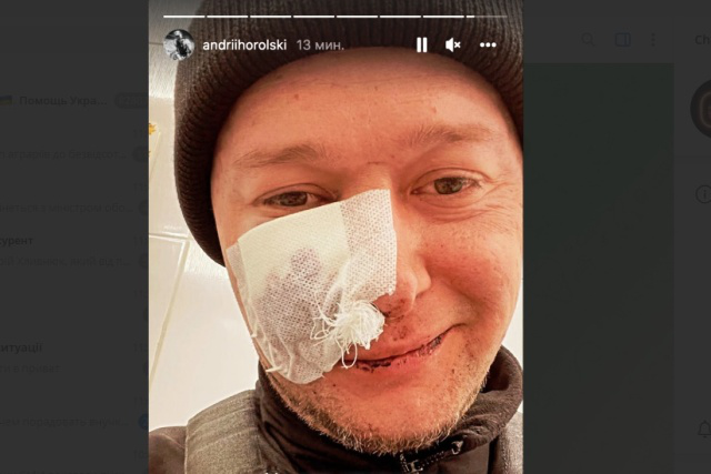 Фронтмен «Бумбоксу» Андрій Хливнюк отримав осколкове поранення