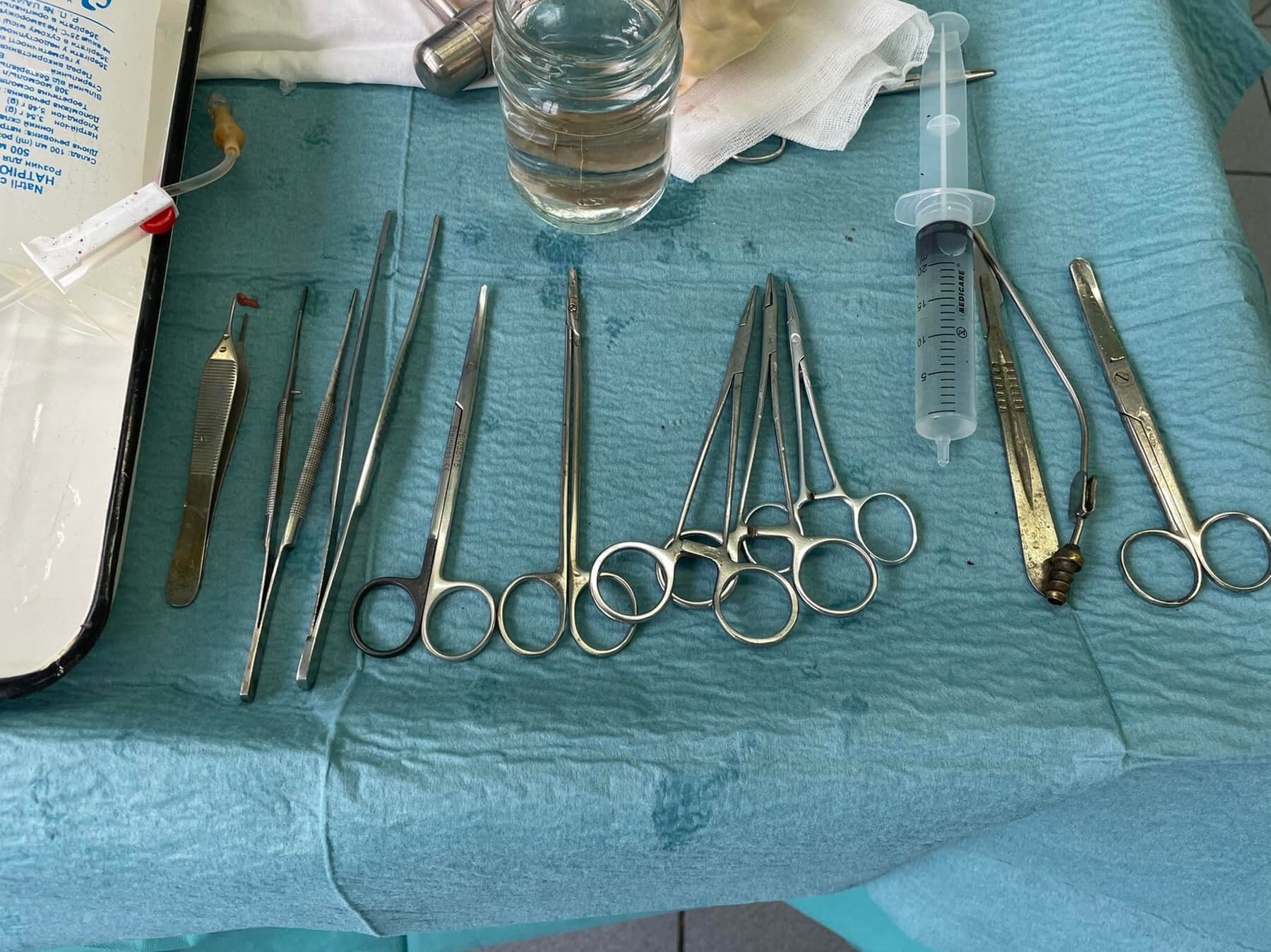 У Волинській обласній лікарні виконали першу трансплантацію