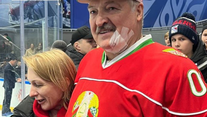 лукашенко отримав ключкою по обличчю під час хокейного матчу (відео)