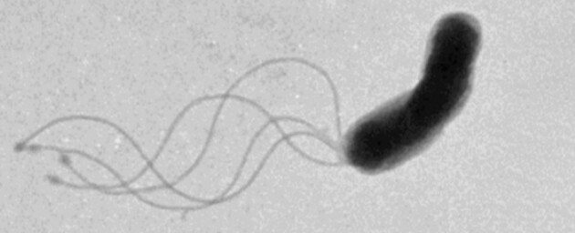Вченим вдалося з'ясувати, як рухаються бактерії